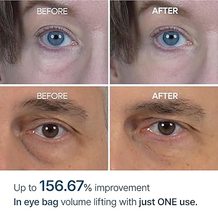 Velisse™ Dr.Melaxin Eyephalt Cream